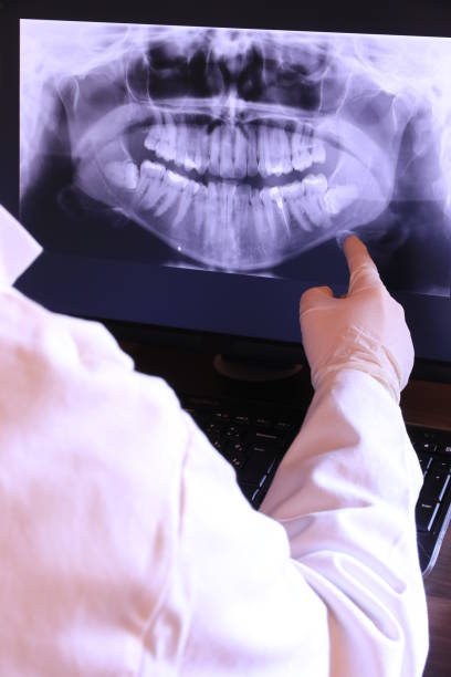 Best Broken or Cracked Tooth Emergency Dentist in Walnut Creek, NC
