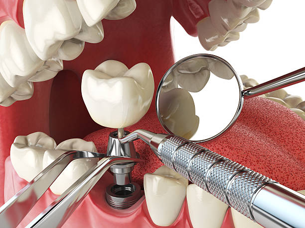 Best Mobile Emergency Dentist in Walnut Creek, NC
