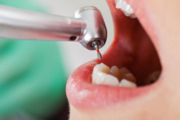 Best Pediatric Emergency Dentist in Walnut Creek, NC